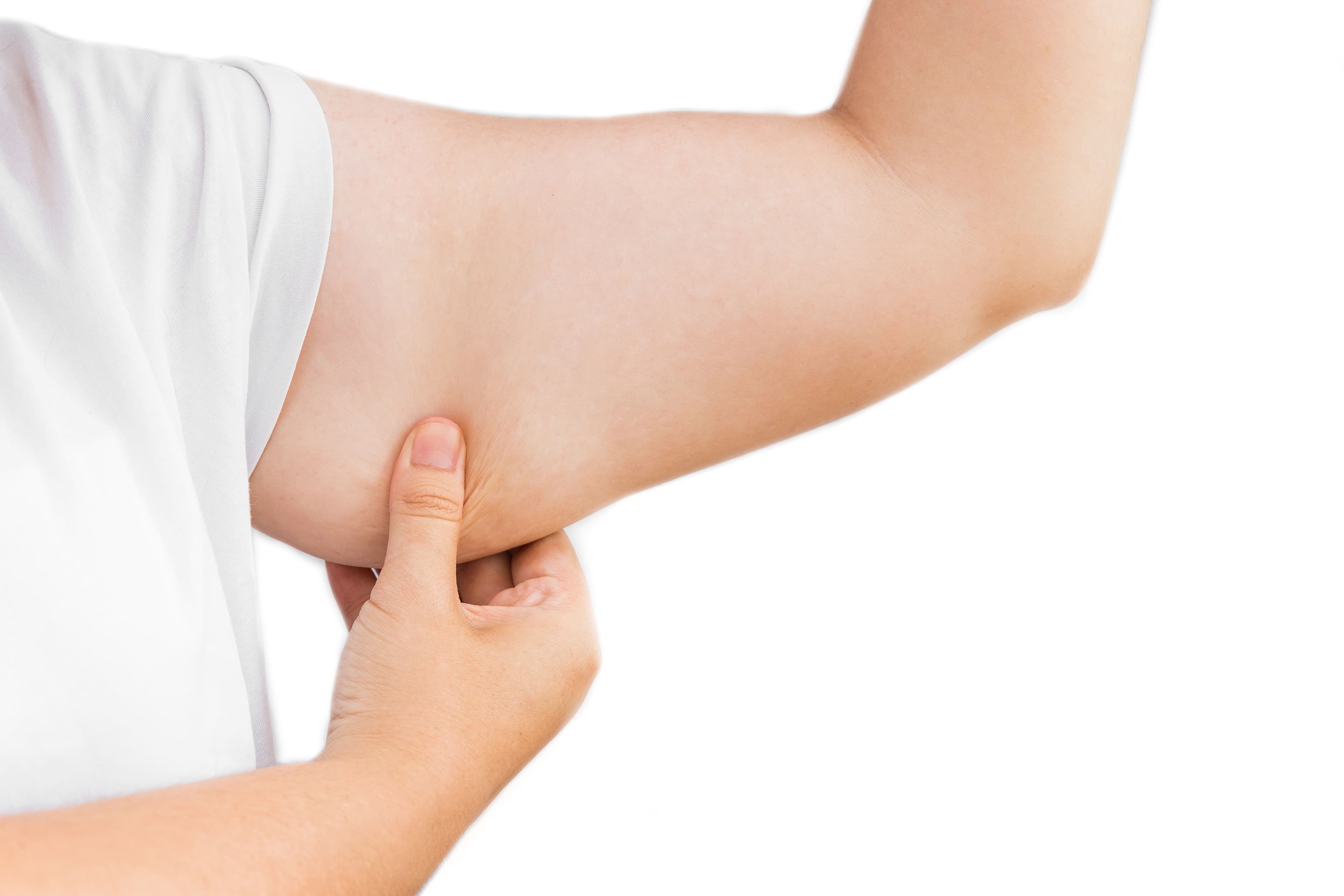 Arm Liposuction