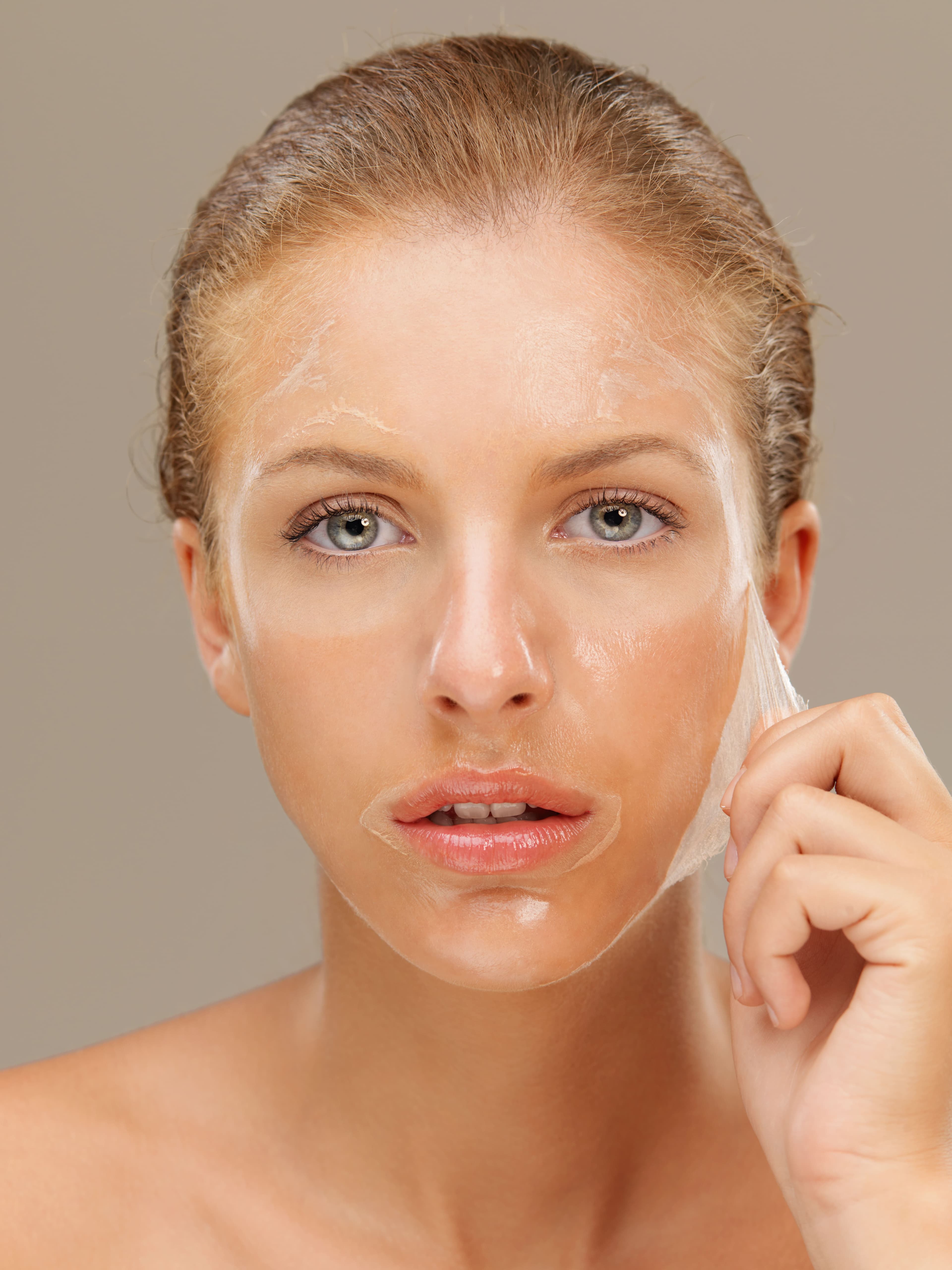 Chemical Peels