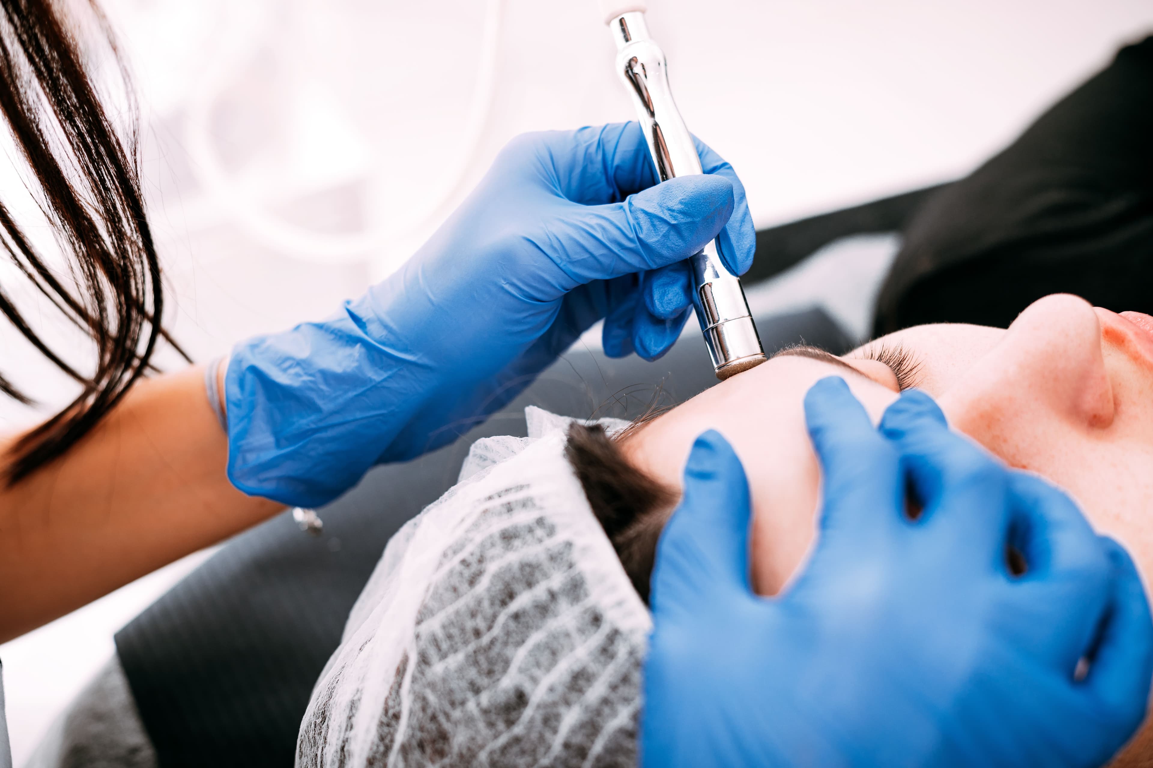 Dermabrasion