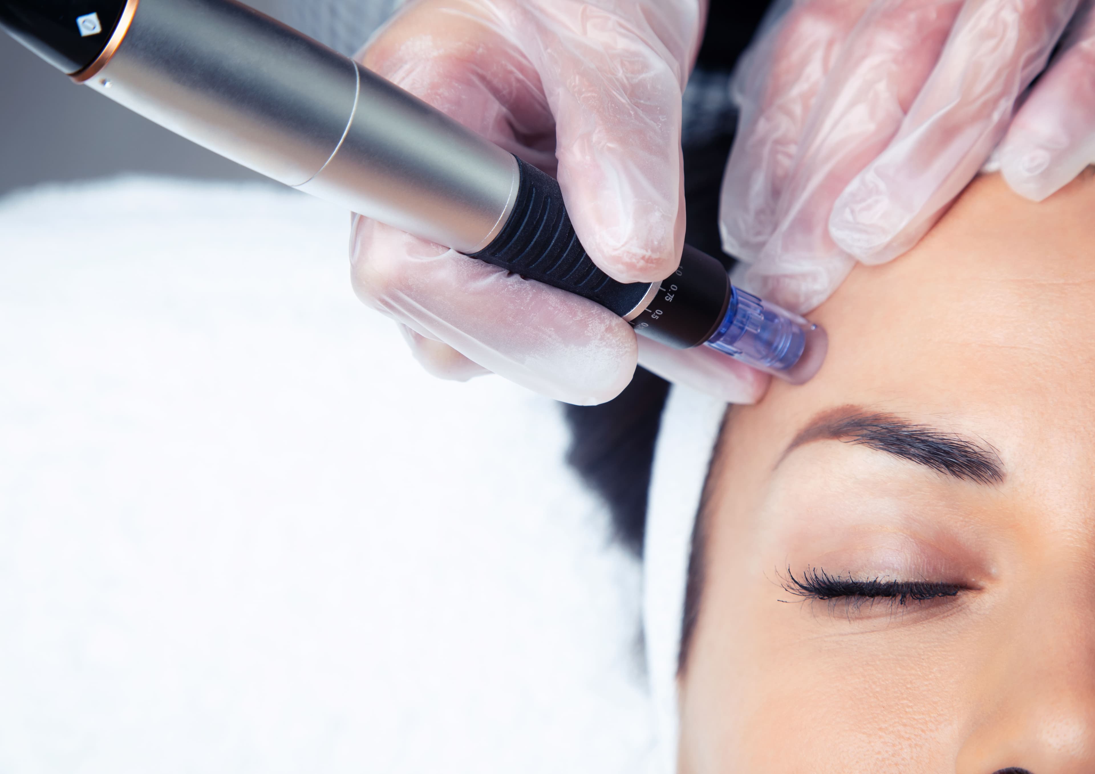 Dermapen