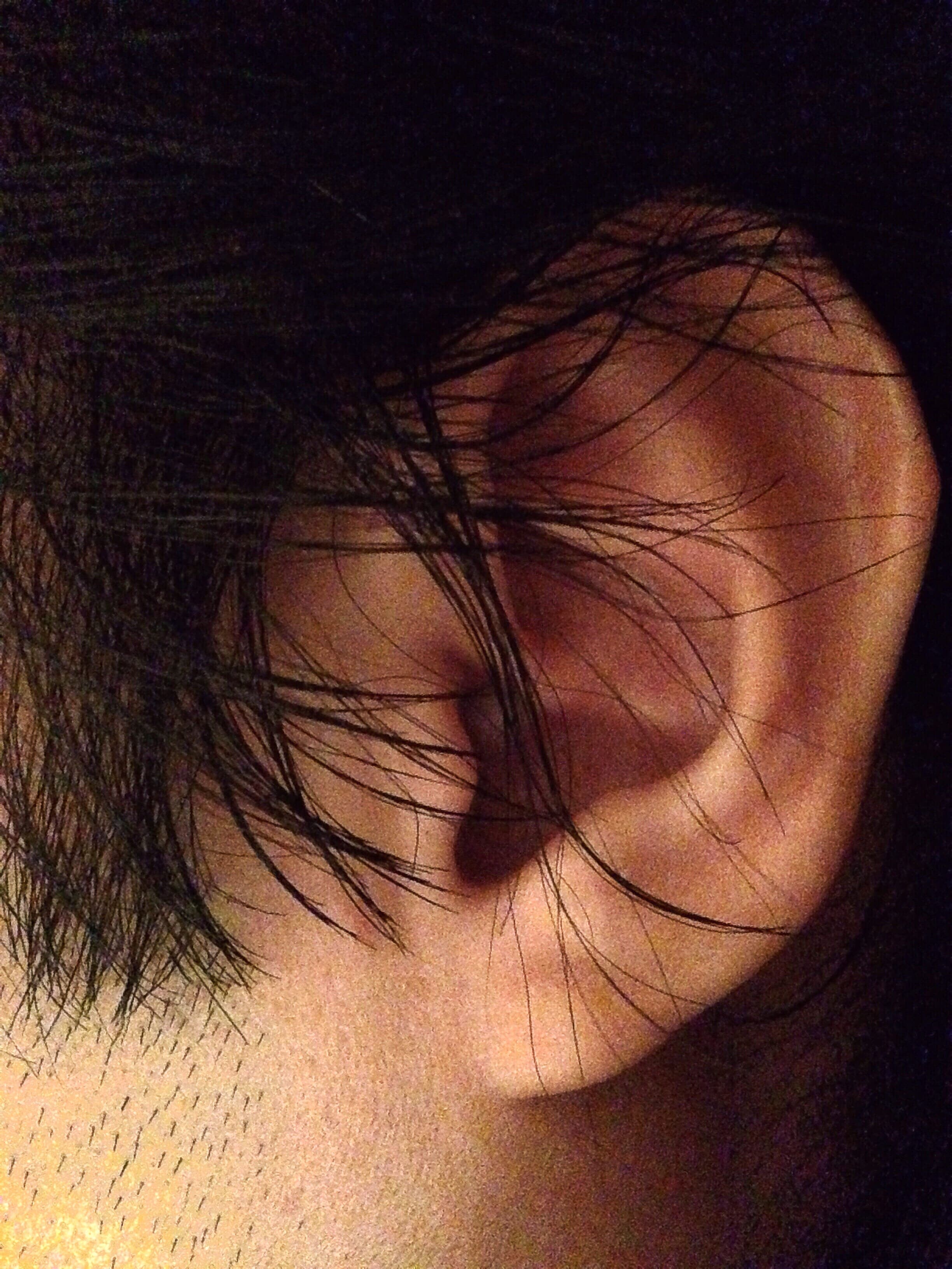 Ear Repair