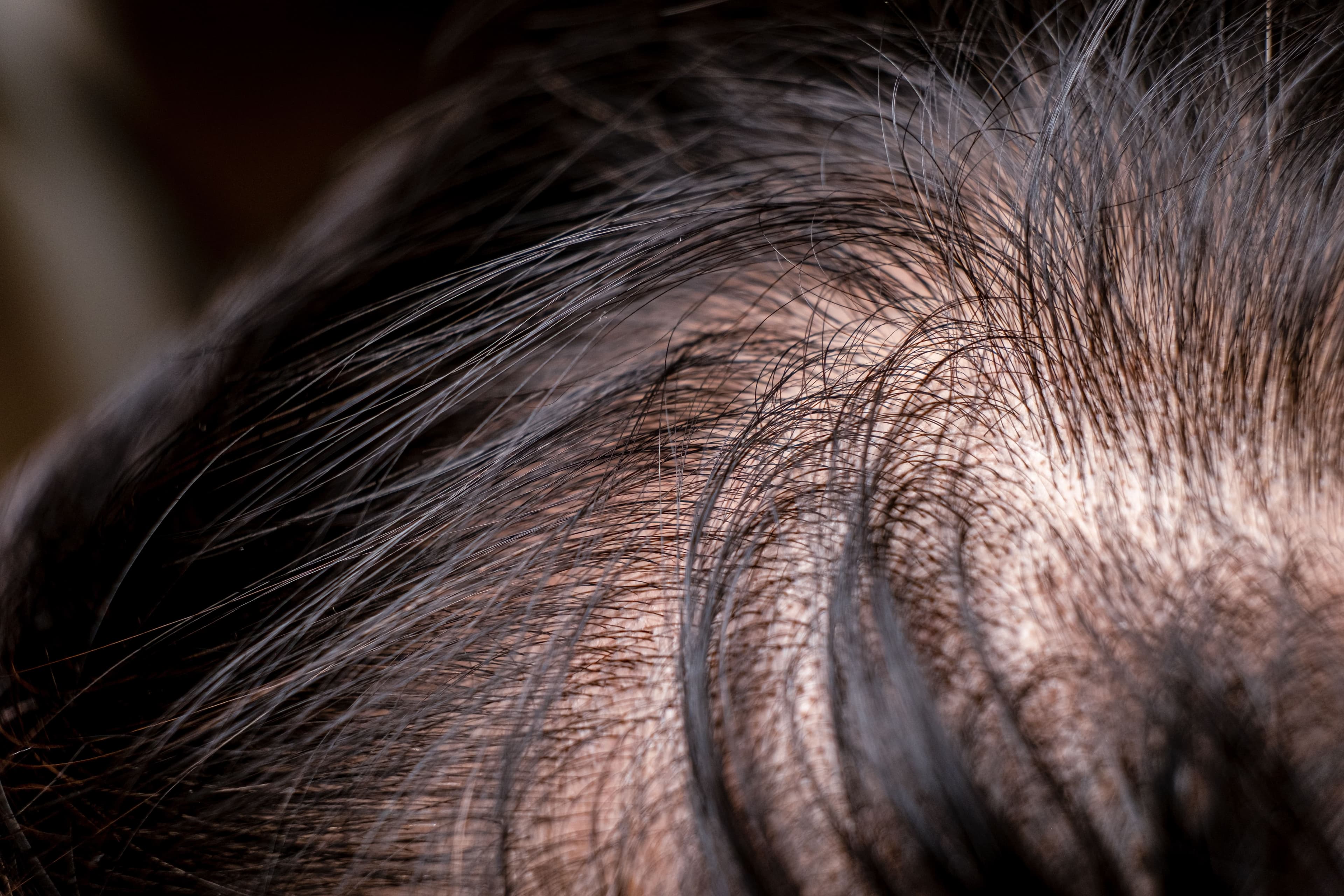 Hair Loss Treatment