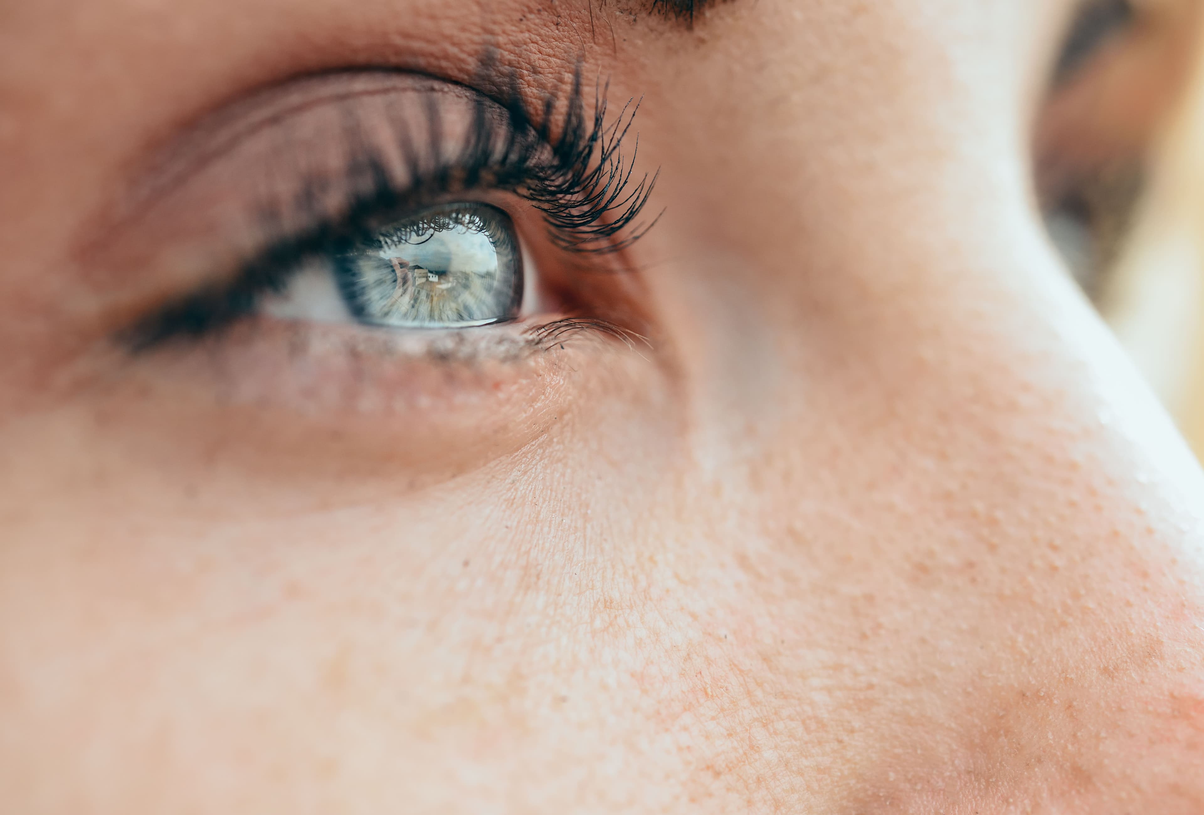 Ptosis Surgery