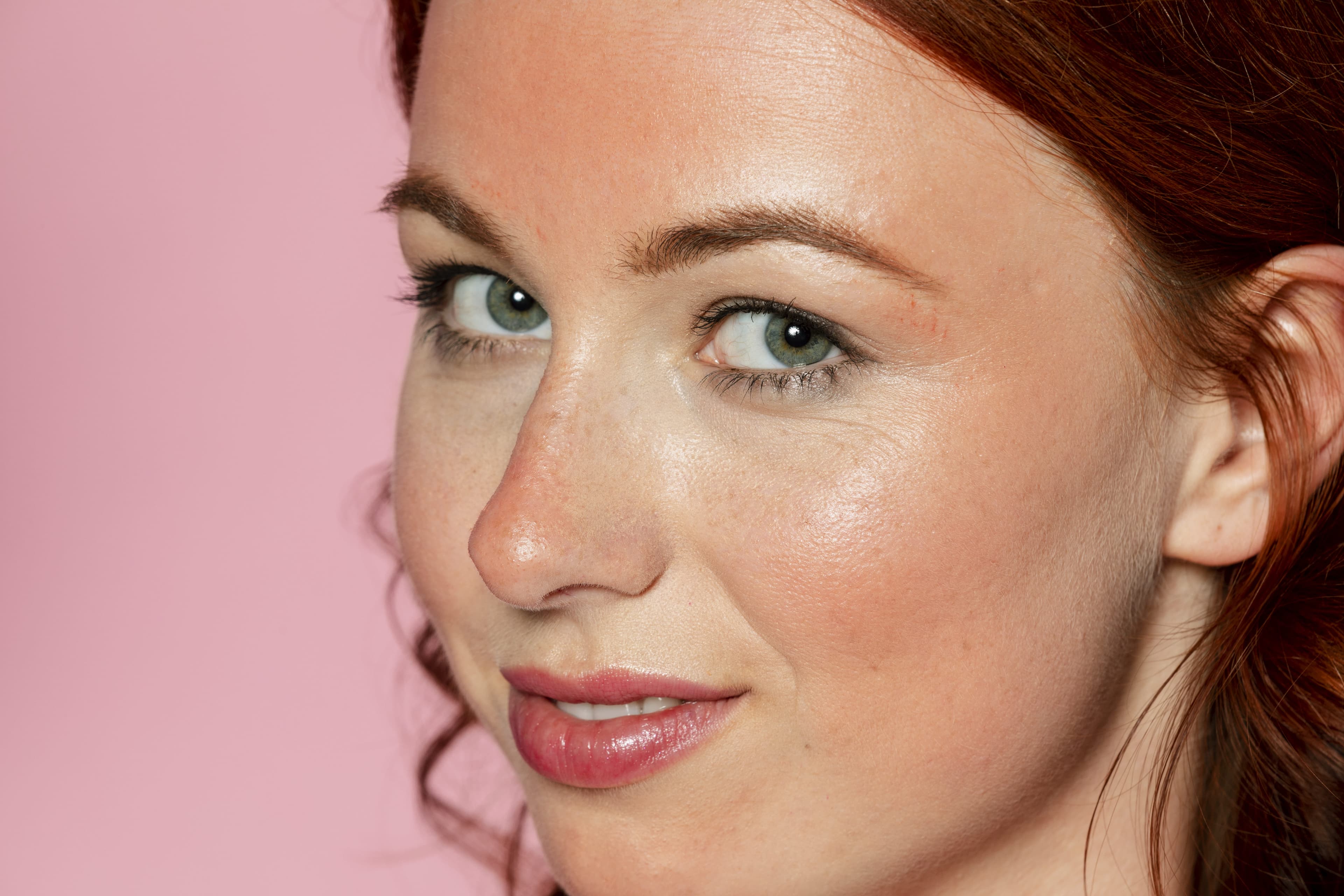 Rosacea Treatment