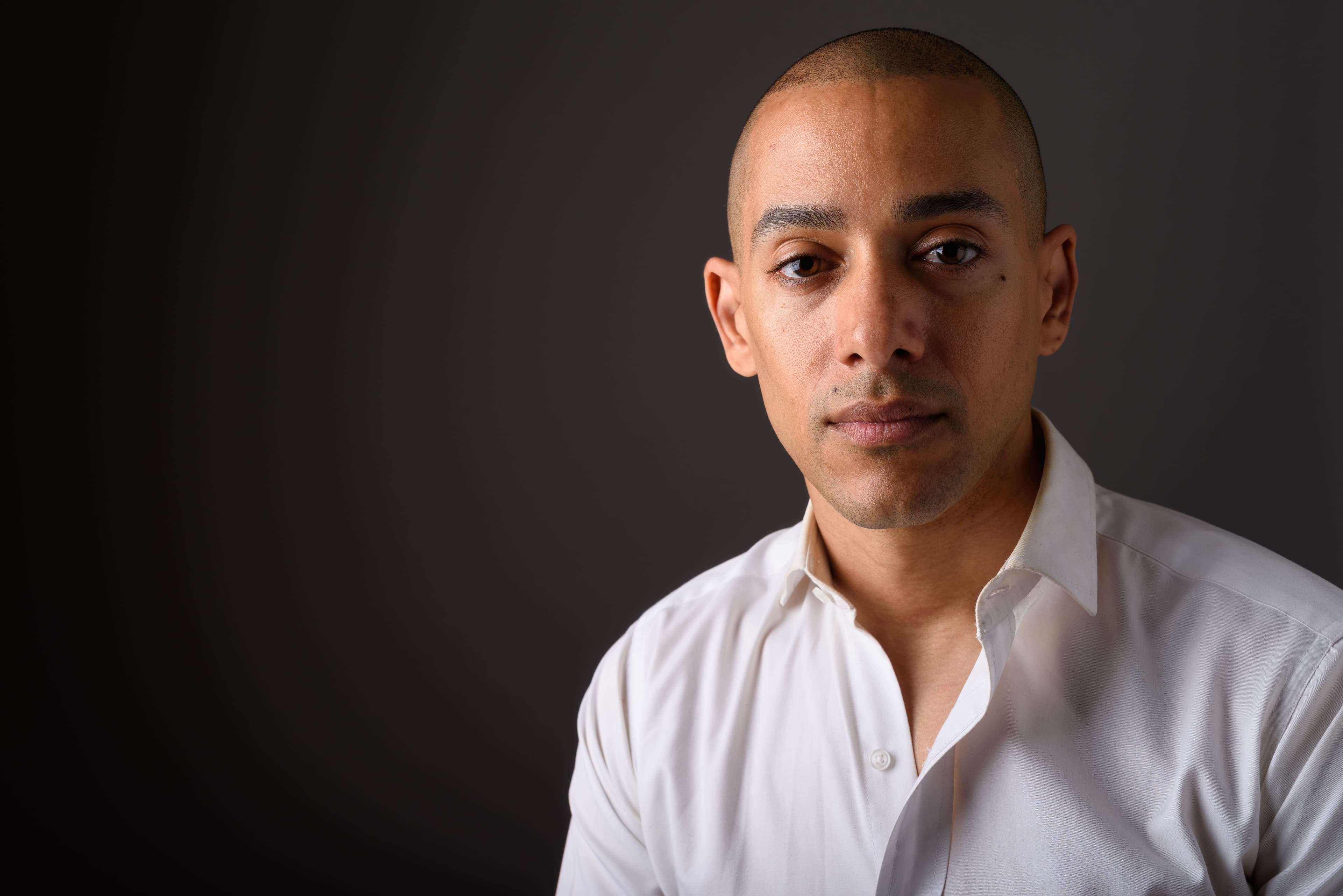 Scalp Micropigmentation