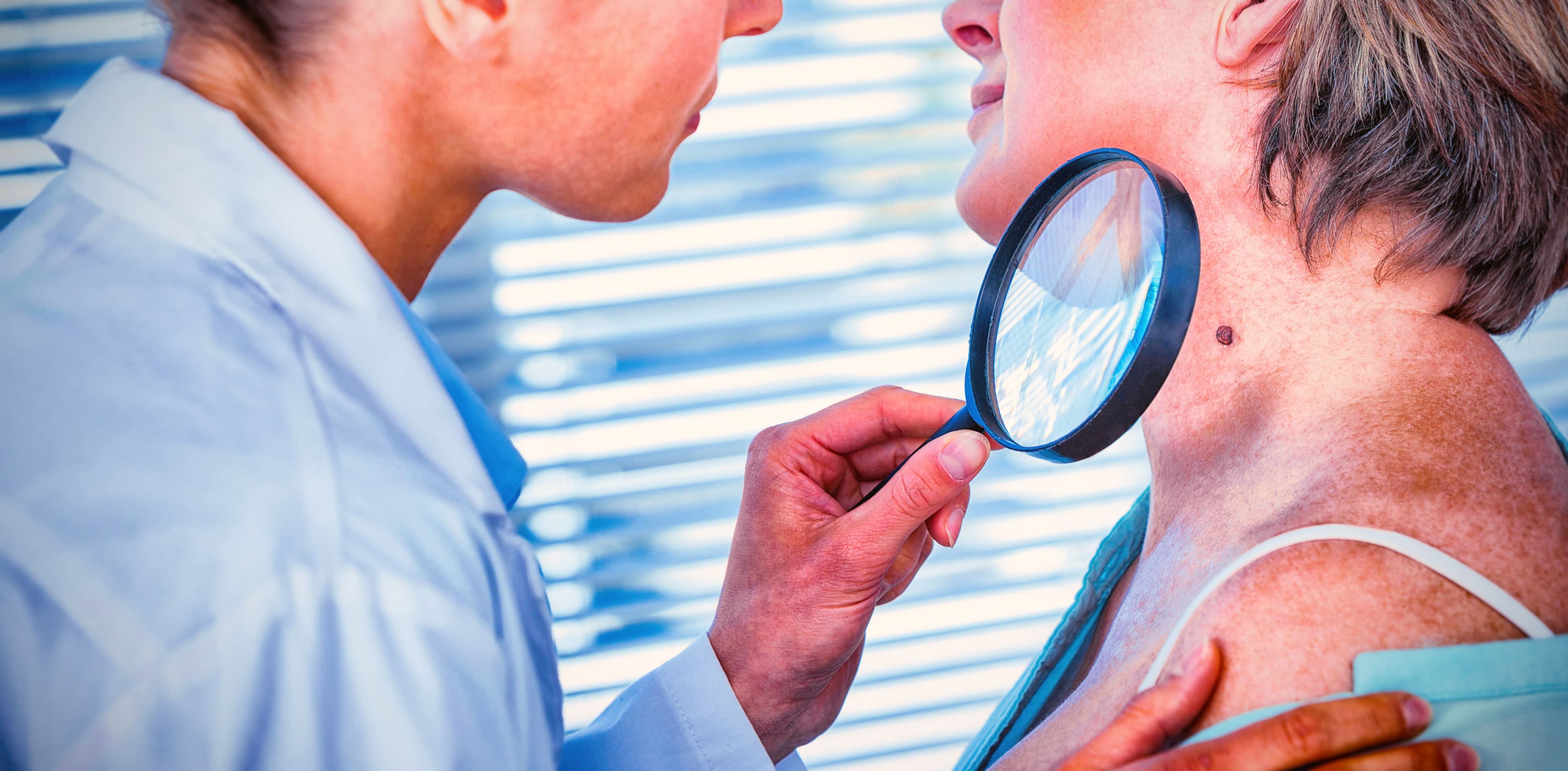 Skin Cancer Treatment
