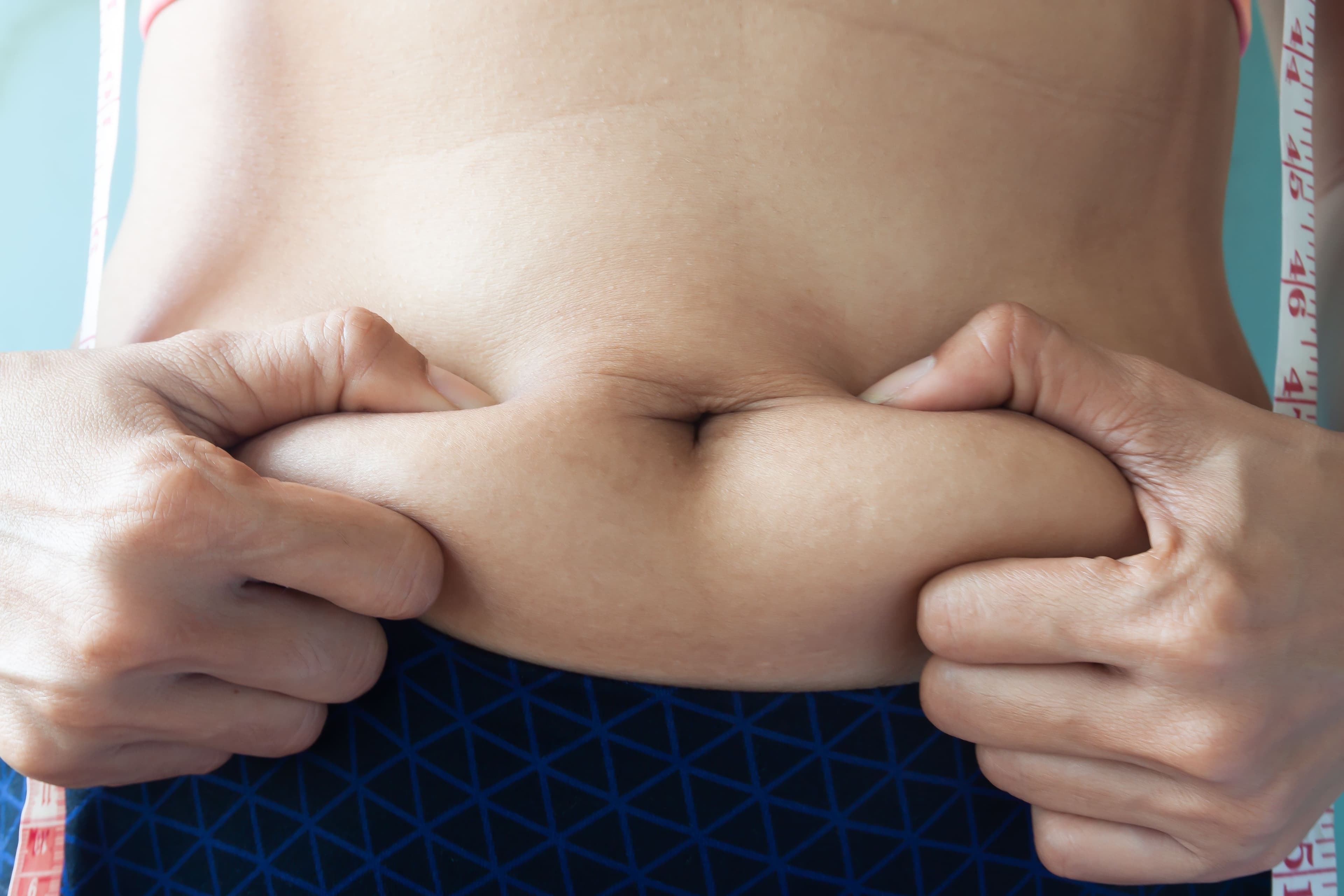 Tummy Tuck